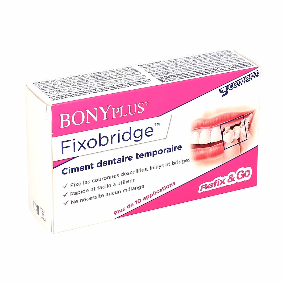 Bonyplus Fixobridge ciment dentaire temporaire - Prothèse et bridge